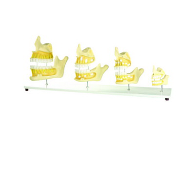 Diş Gelişim Modeli K20330